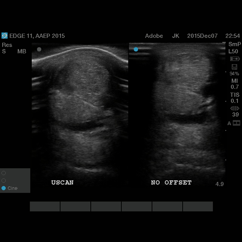 MXR U standoff, eksempel 3